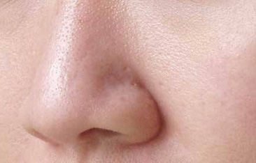 Skin Care Tips