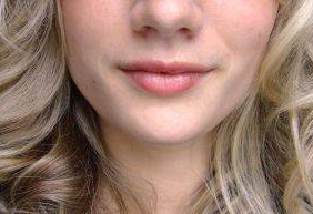 get rid of facial hair