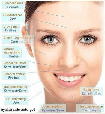 Hyaluronic Acid