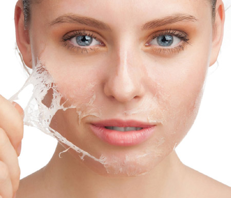 Peeling