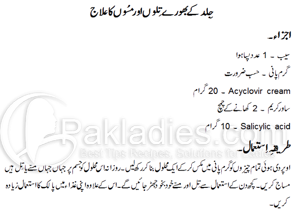 remove moles from face