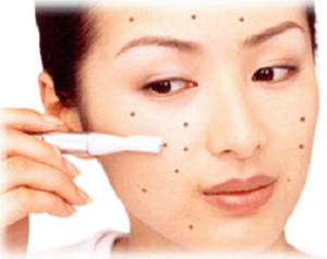 Tips For pimples