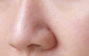 Skin Care Tips