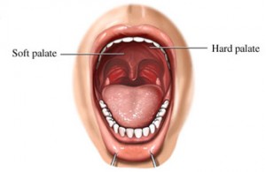 how to get rid of snoring