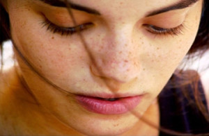 Treatment for Hyperpigmentation on Face