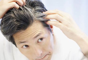 Home Remedies to Stop Premature Graying of Hair