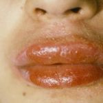 chemical reaction of cosmetics