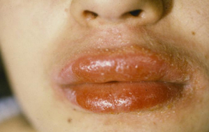 Chemical Reaction of Cosmetics