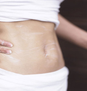 Body Contouring Cream by Dr Khurram