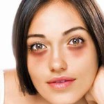 dark circles