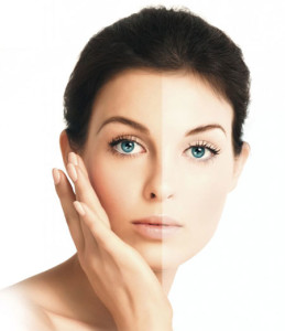 skin whitening cream