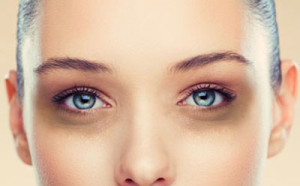 Dark Circles Treatment