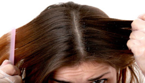 hair falls