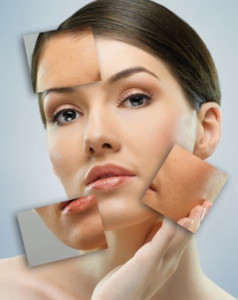 Whitening Cream Side Effects