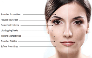 best anti aging treatment for skin