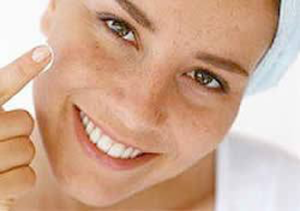 freckles removal cream