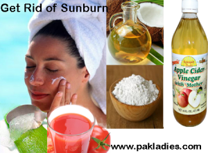 treatment for sunburns on face