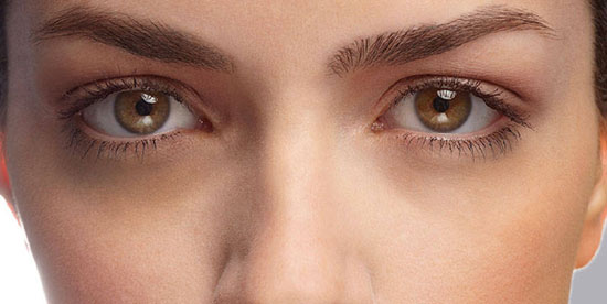 8 Tips to Reduce the Dark Circles