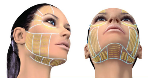 Correcting Sagging Skin