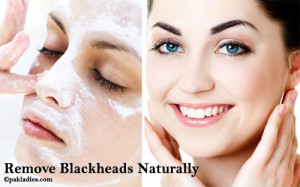 Remove Blackheads Naturally