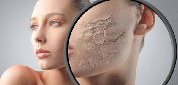 Dry Winter Skin Remedies