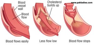 Lower High Cholesterol Diet