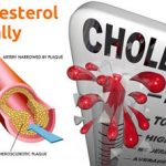 Lower High Cholesterol 2
