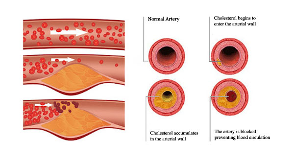 How to Reduce Saturated Fat